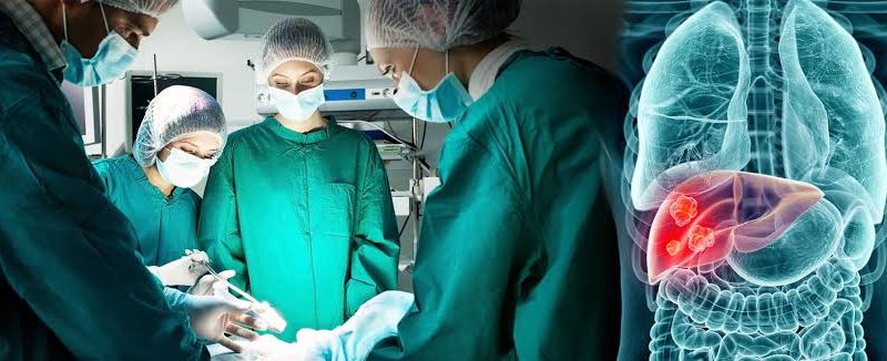 Liver Surgery Cost in India